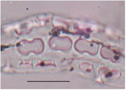 Fitolitos en plantas